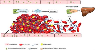 Silver Jubilee of Stroke Thrombolysis With Alteplase: Evolution of the Therapeutic Window